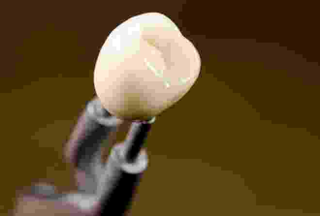 Keramikkrone